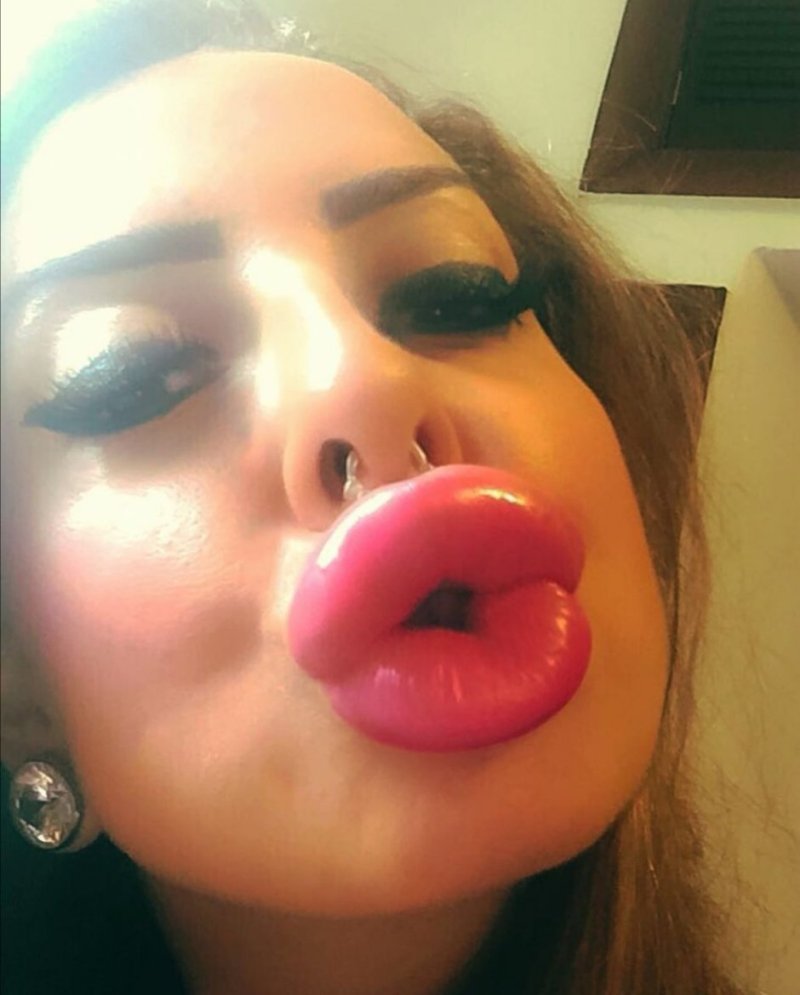 Pic: Huge lips