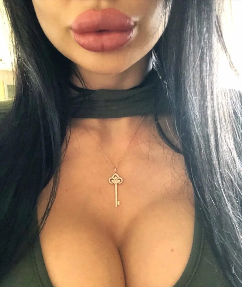 Pic: Girls with pumped lips are beautiful