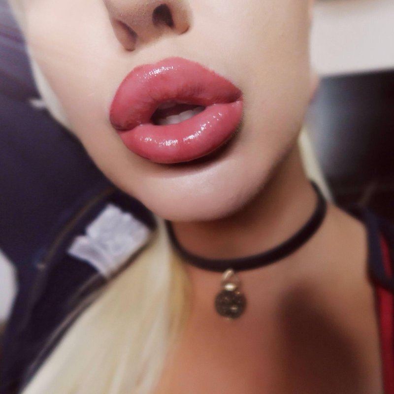 Pic: Bimbo lips