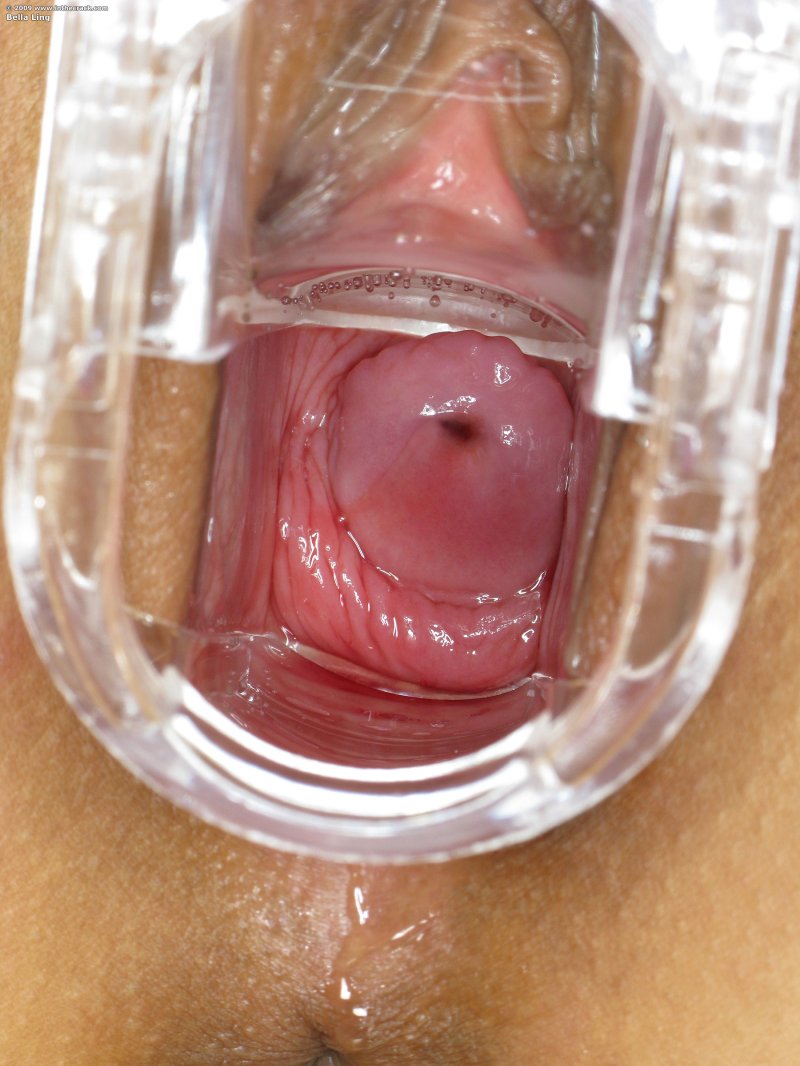 Pic: Vagina close -up from the inside