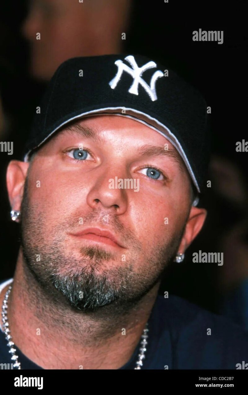 Fred Derst is young