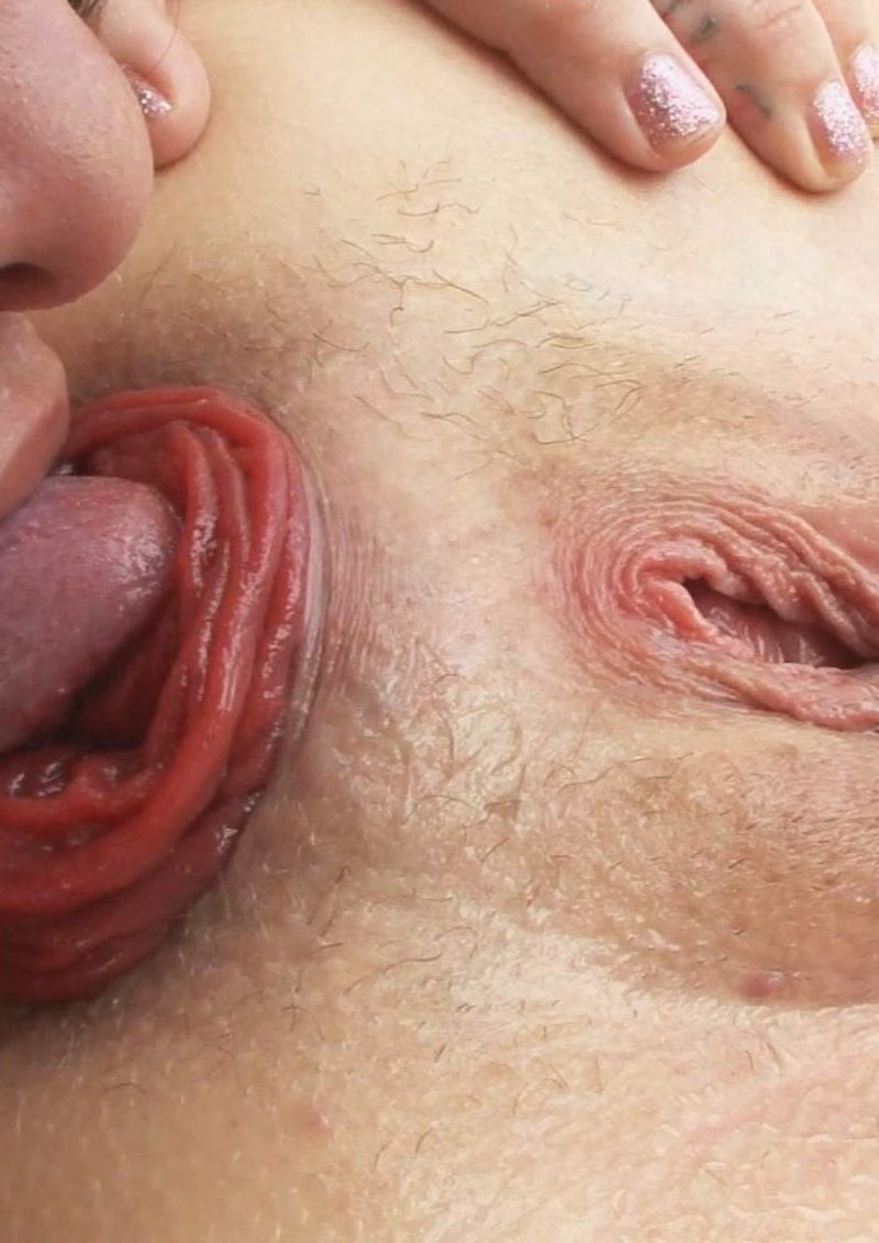 Anal out