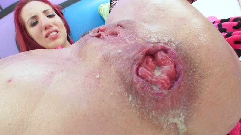 Anal