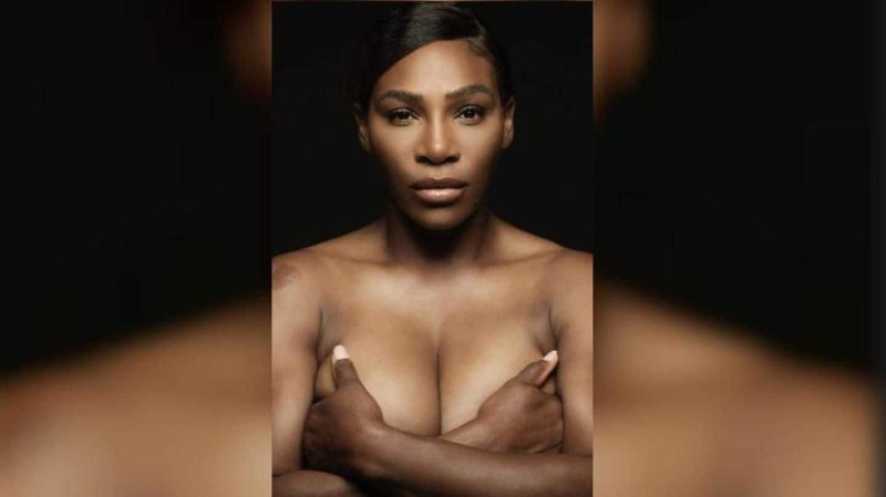 Pic: Serena Williams was exposed