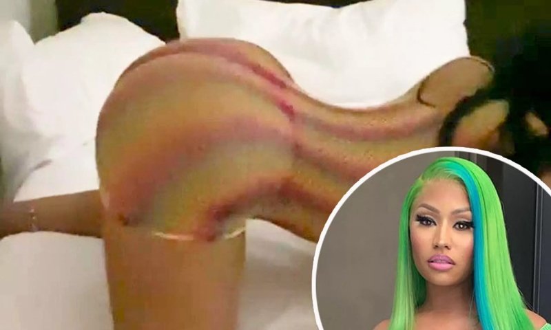 Nicky Minaj