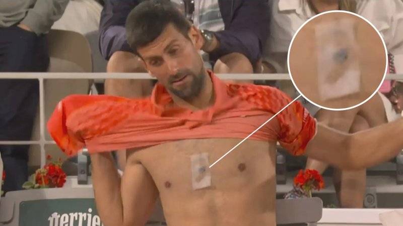 Novak Jokokovych Torsos