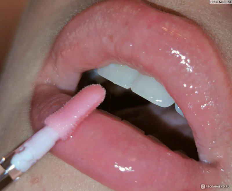 Lip gloss