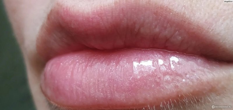 Lip gloss