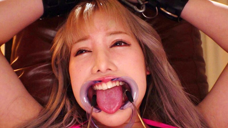 Gag for the mouth