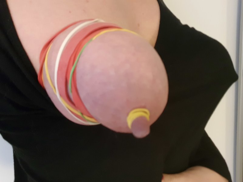 Artificial breasts