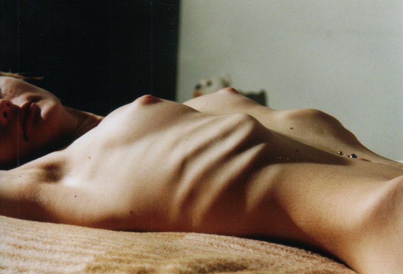 The abdomen of anorexics