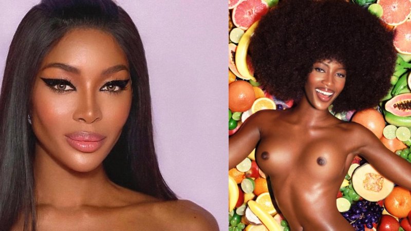 Naomi Campbell after plastic